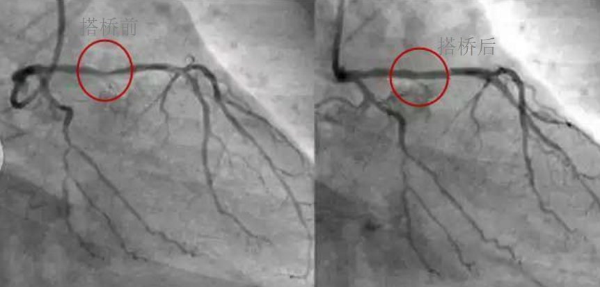 1505957553888930.png blob.png